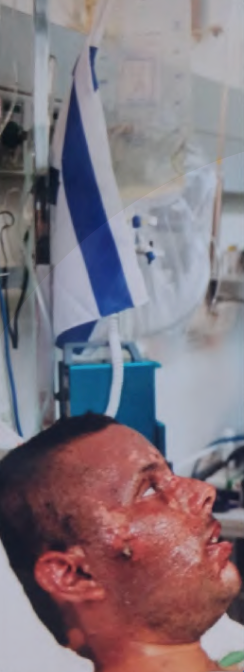 Omer Golan in hospital during his recovery